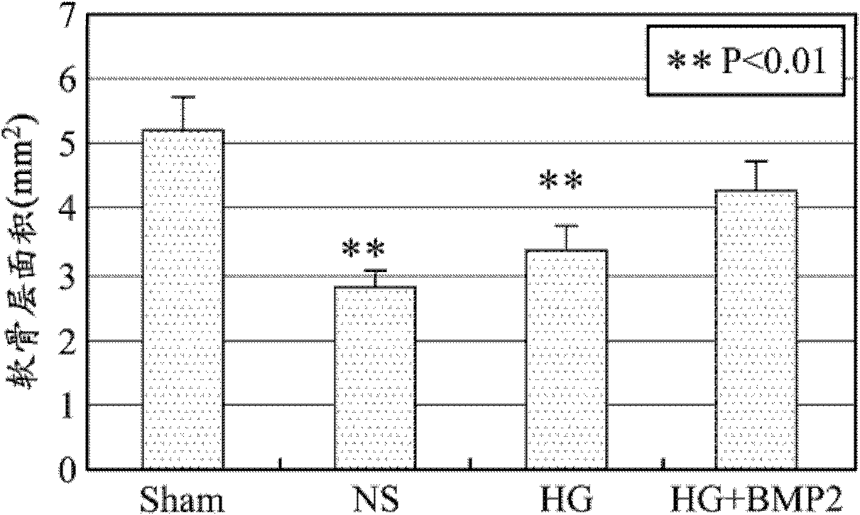 Thermal responsive composition for treating bone diseases