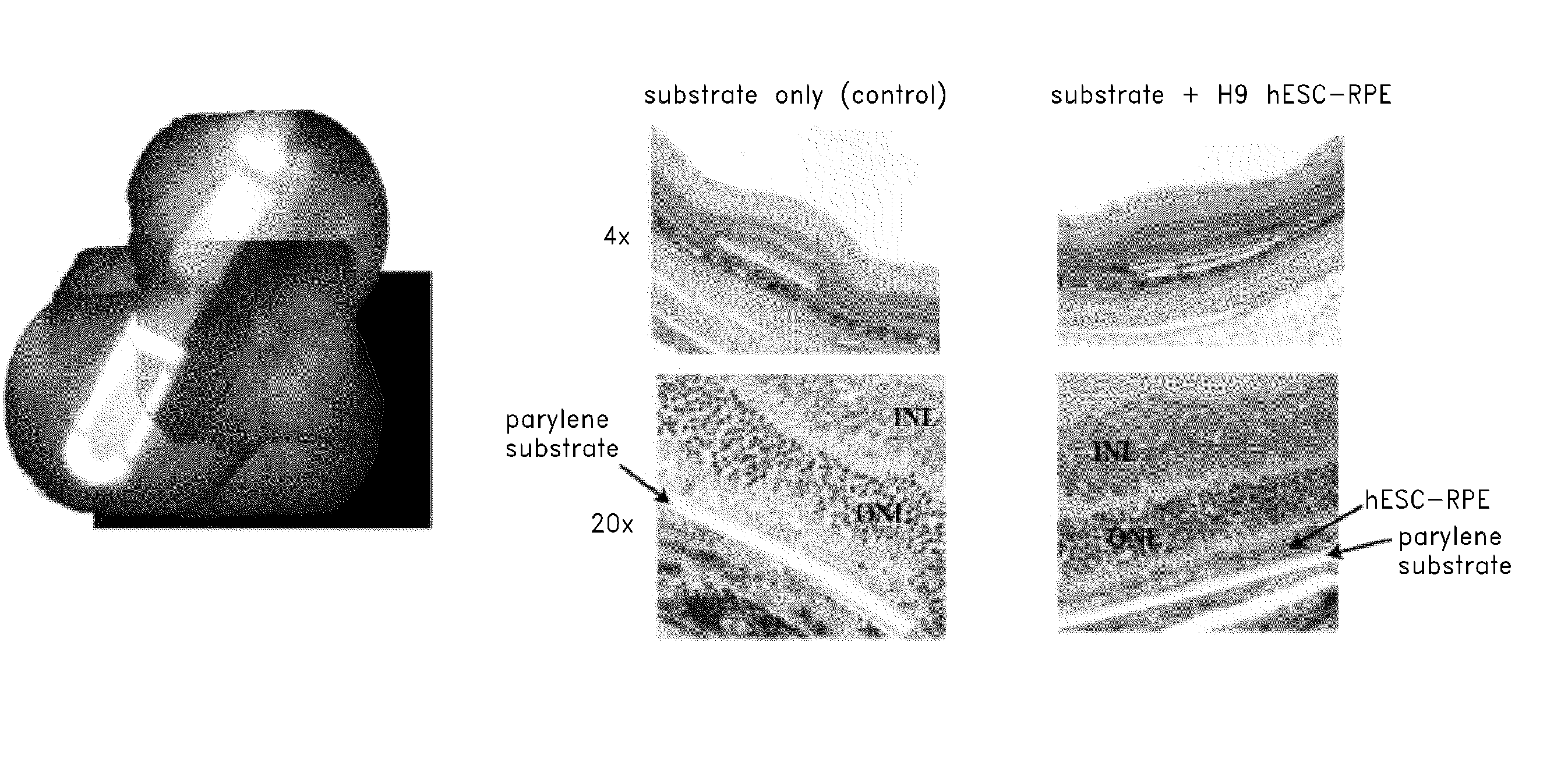 Biocompatible substrate for facilitating interconnections between stem cells and target tissues and methods for implanting same