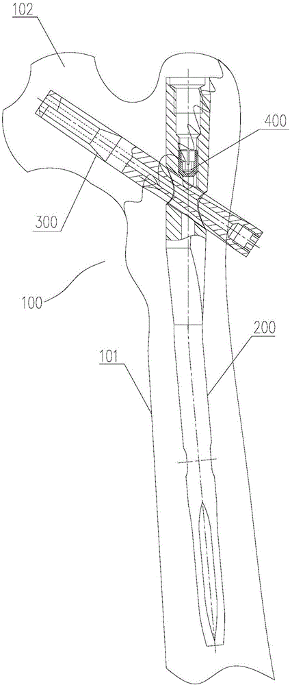 Lag screw