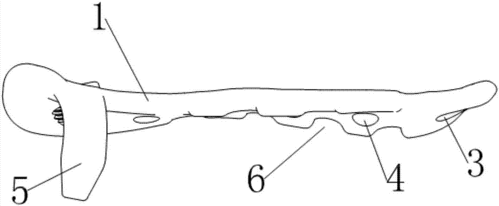 A posterior fixation plate for acetabular anterior and posterior column fractures