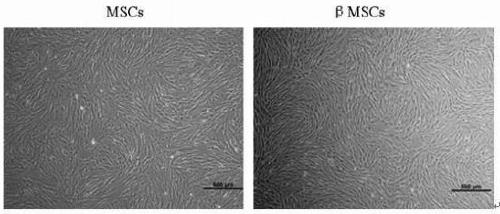 A preparation method of exosomes and exosomes and its application in the preparation of drugs or preparations for treating sepsis