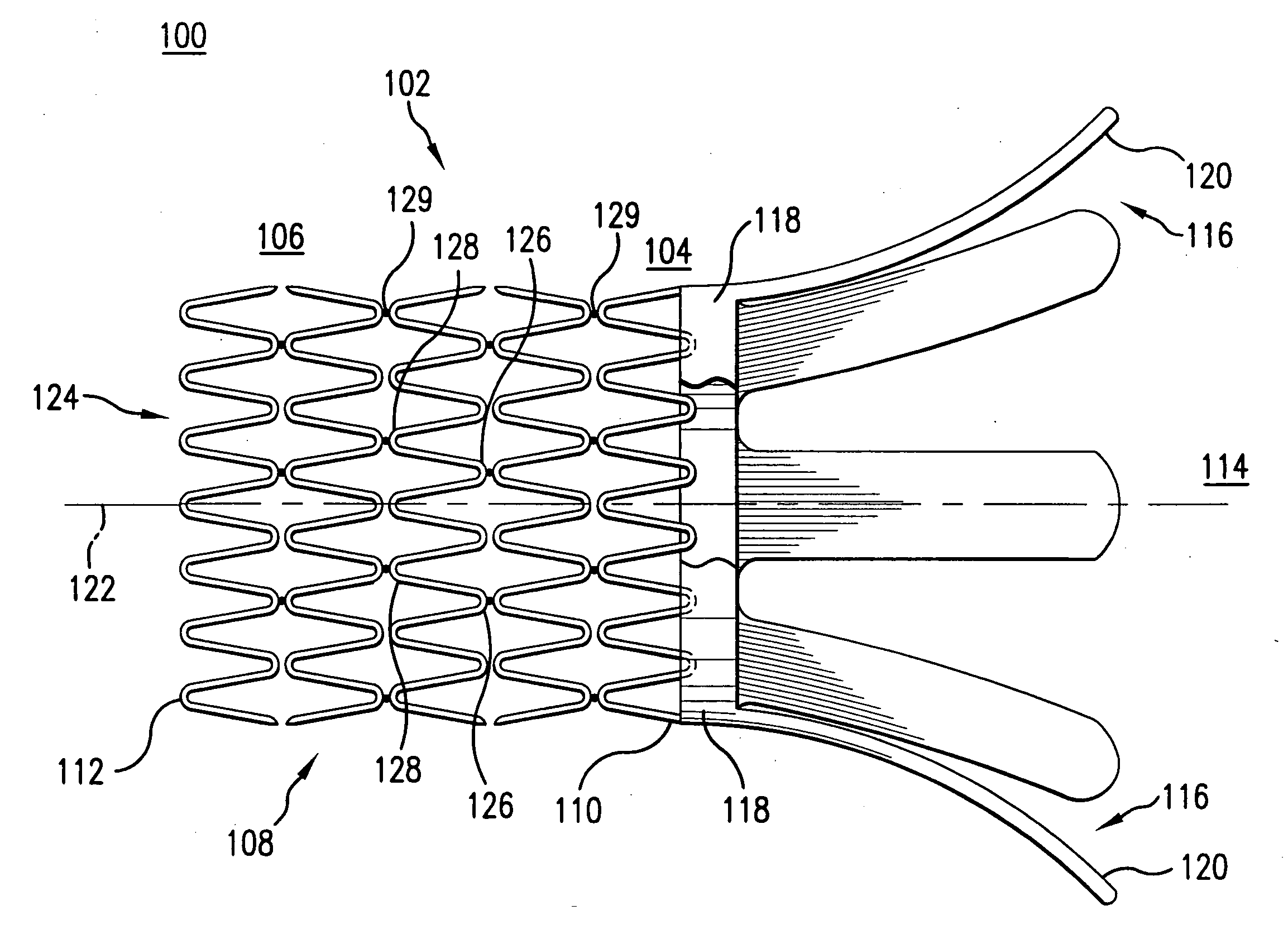 Ostium stent system