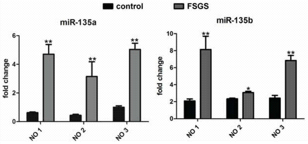 Uses of mir‑135 and its related drugs