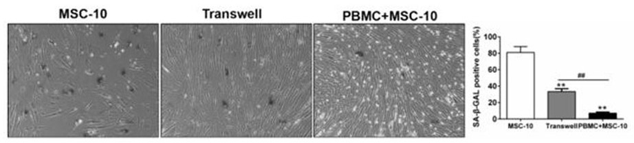 Method for resisting human mesenchymal stem cell aging and enhancing stem characteristics of human mesenchymal stem cells