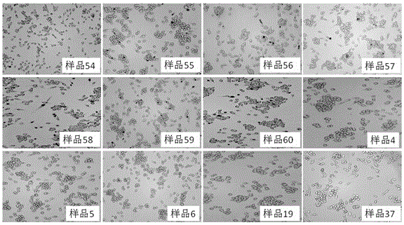 Panax notoginseng saponin composition and preparation method and application thereof