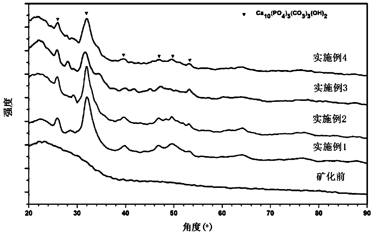 Degradable regenerative medical material for promoting tissue in-situ regeneration and preparation method of medical material