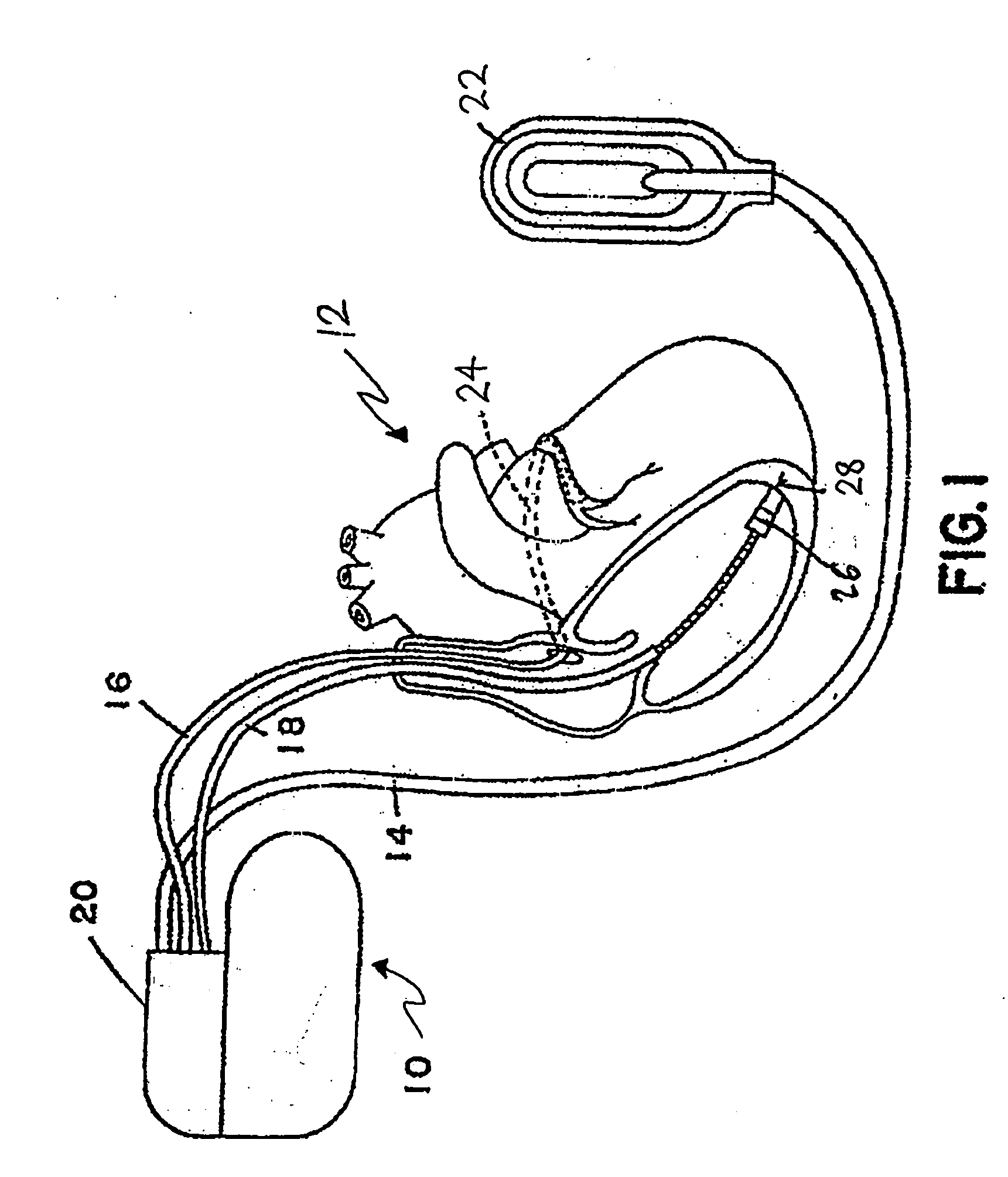 Welding methods and apparatus for batteries