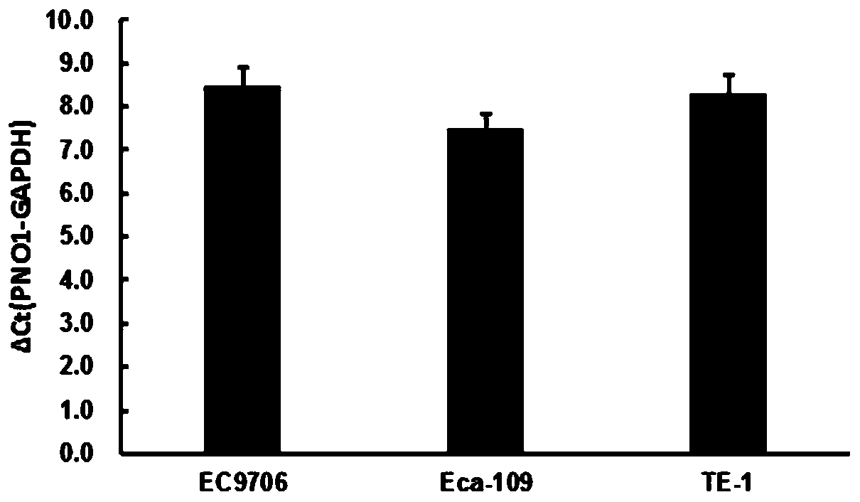 Application of PNO1 inhibitor to preparation of esophagus cancer treatment medicines