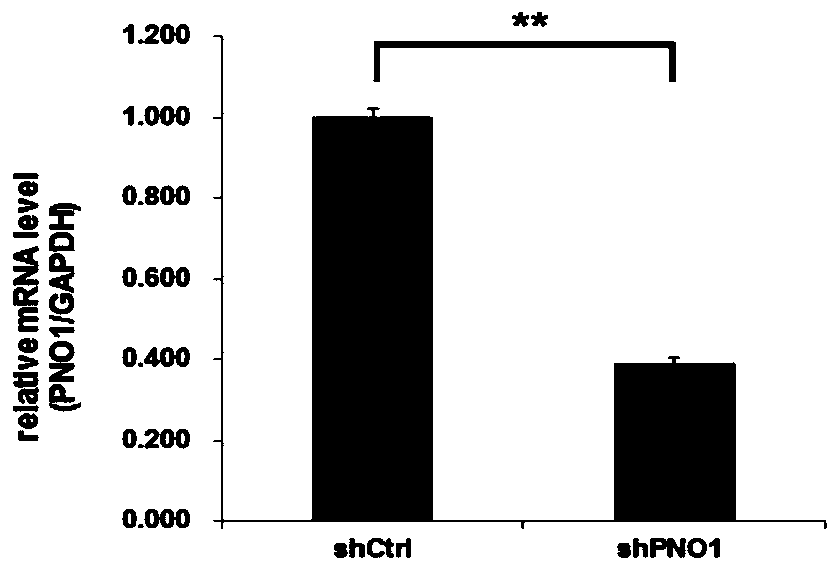 Application of PNO1 inhibitor to preparation of esophagus cancer treatment medicines