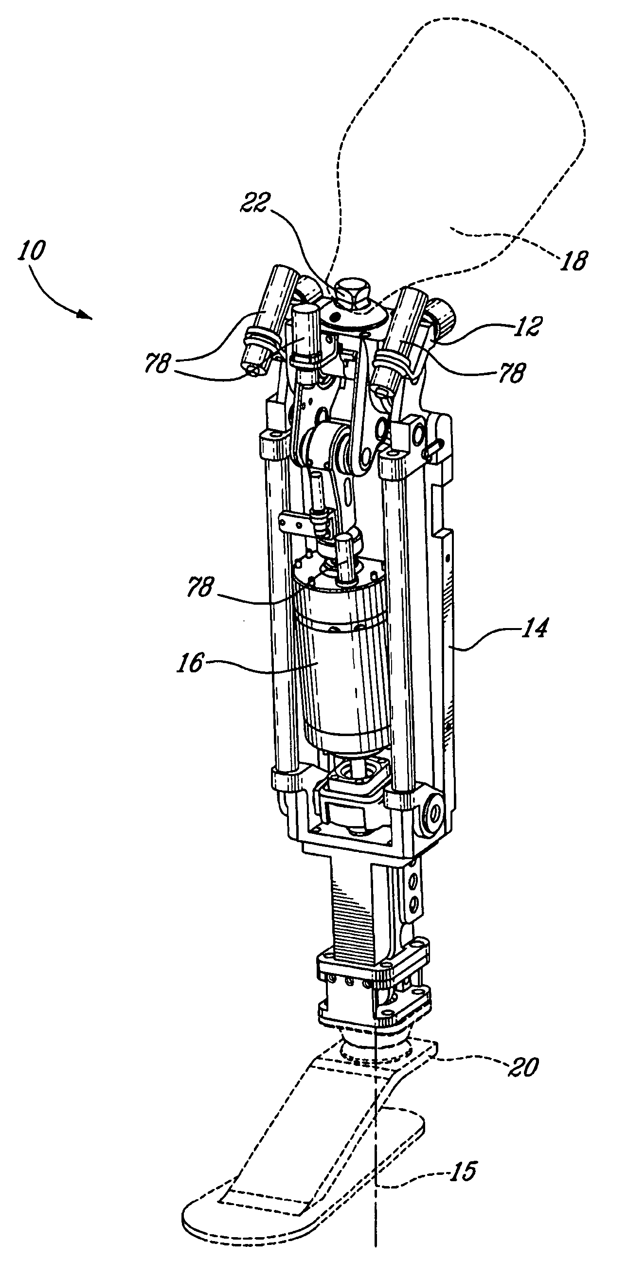 Actuated prosthesis for amputess