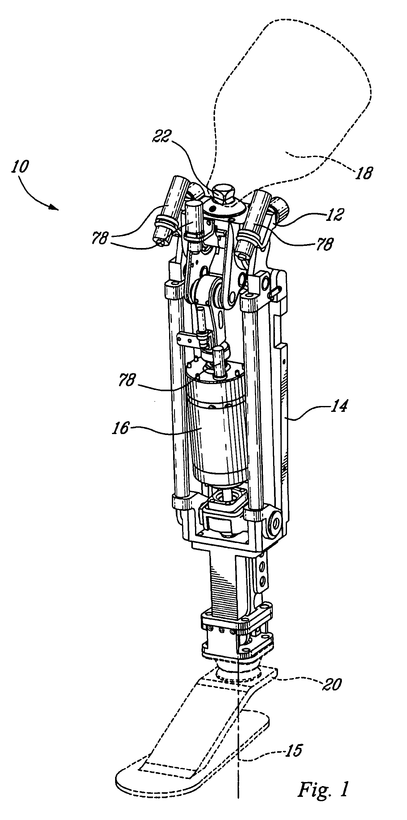 Actuated prosthesis for amputess