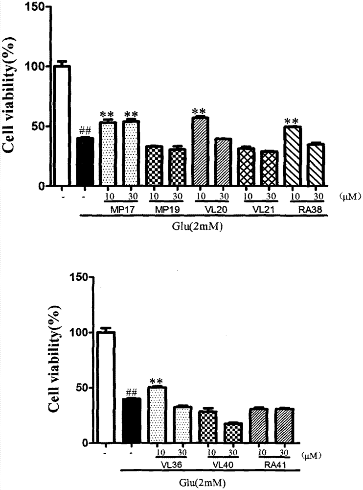 Dimer of rivastigmine, caffeic acid and ferulic acid, preparation method and pharmaceutical composition thereof