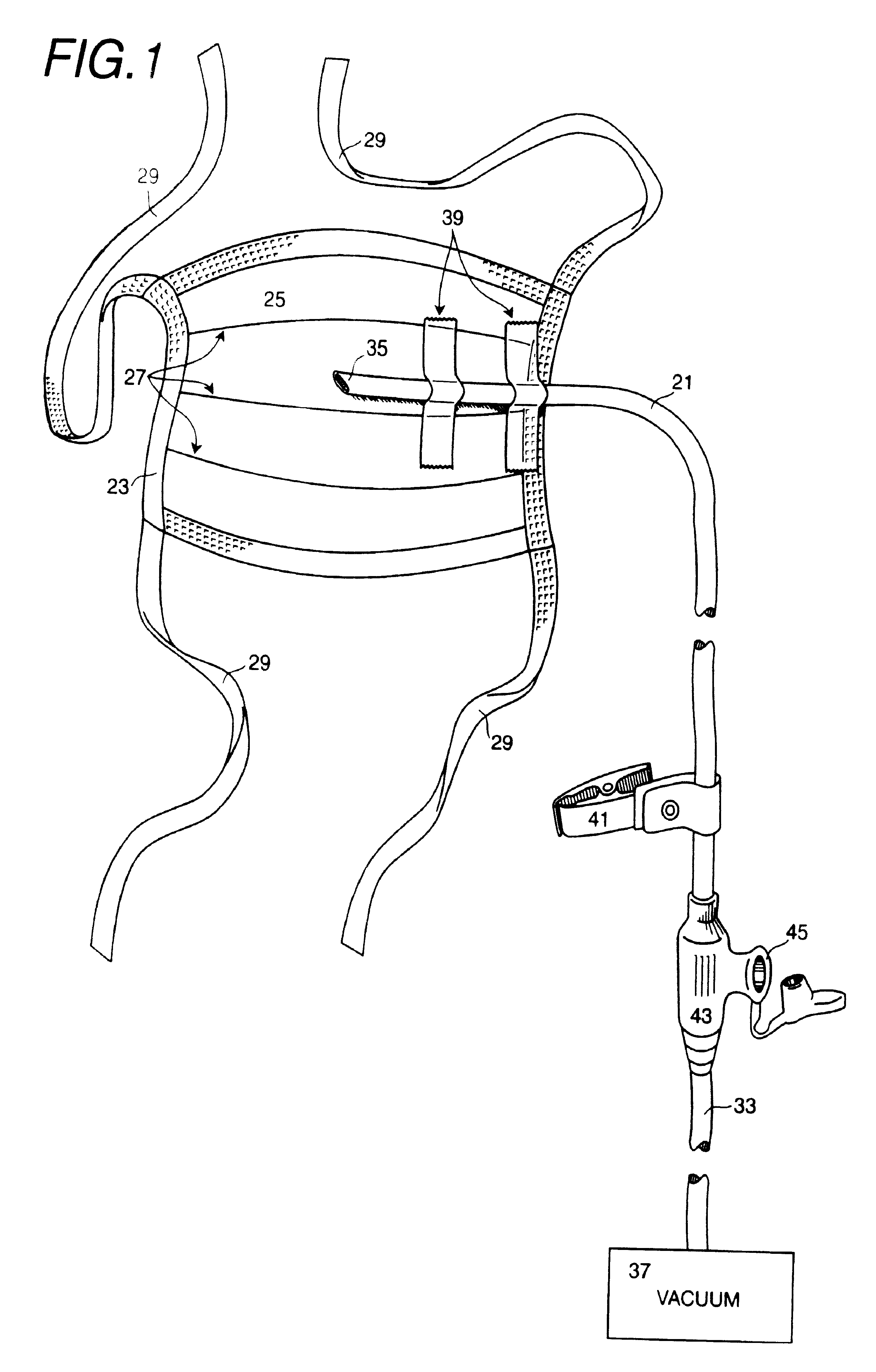 Disposable mask and suction catheter