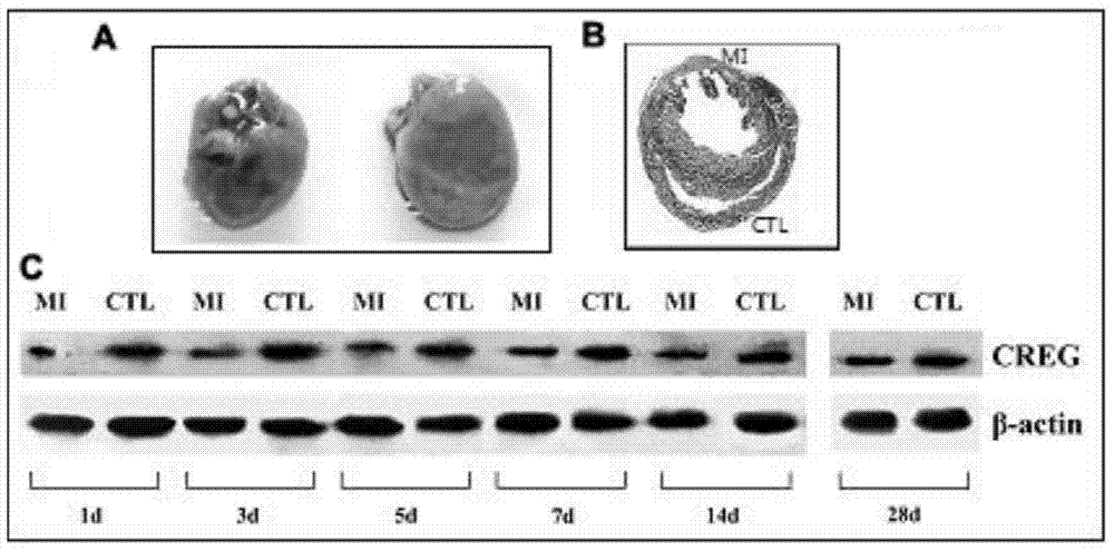 Medical use of creg protein for preventing or treating myocardial infarction