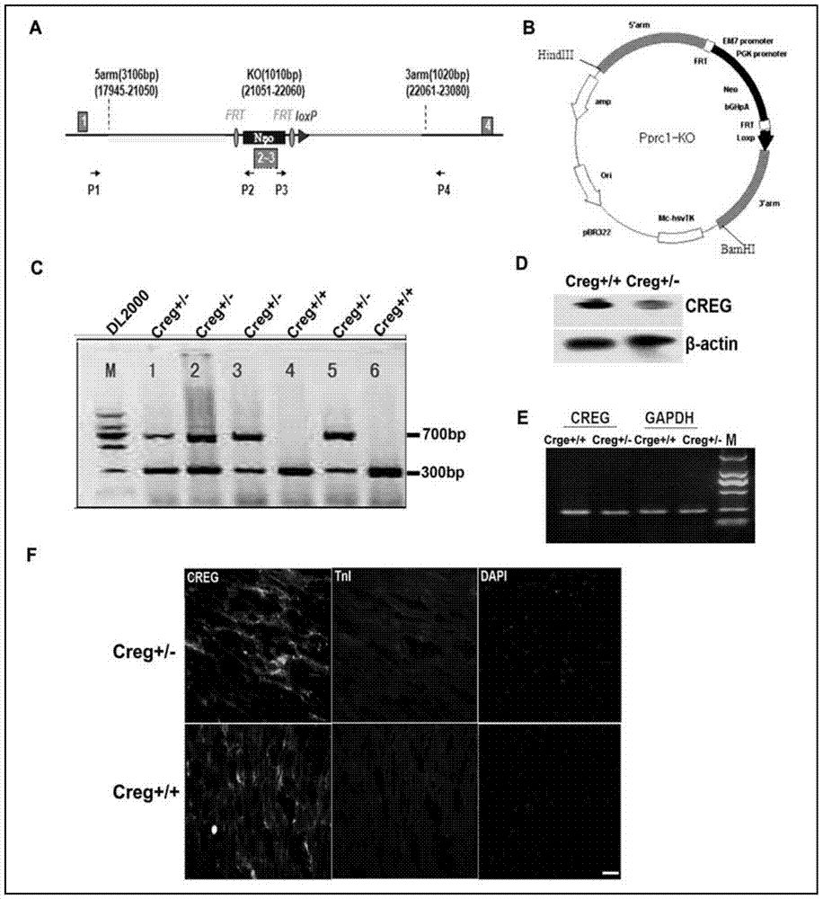 Medical use of creg protein for preventing or treating myocardial infarction