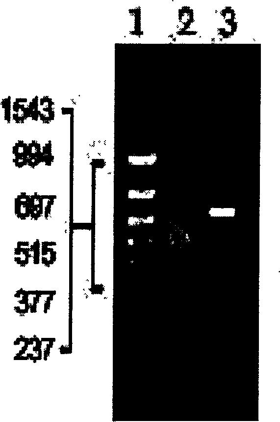 Gene of earthworm plasmin and genetic engineerng strain, construction and application