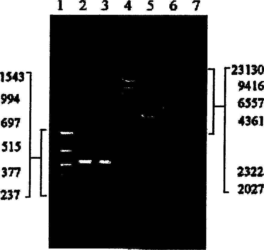 Gene of earthworm plasmin and genetic engineerng strain, construction and application