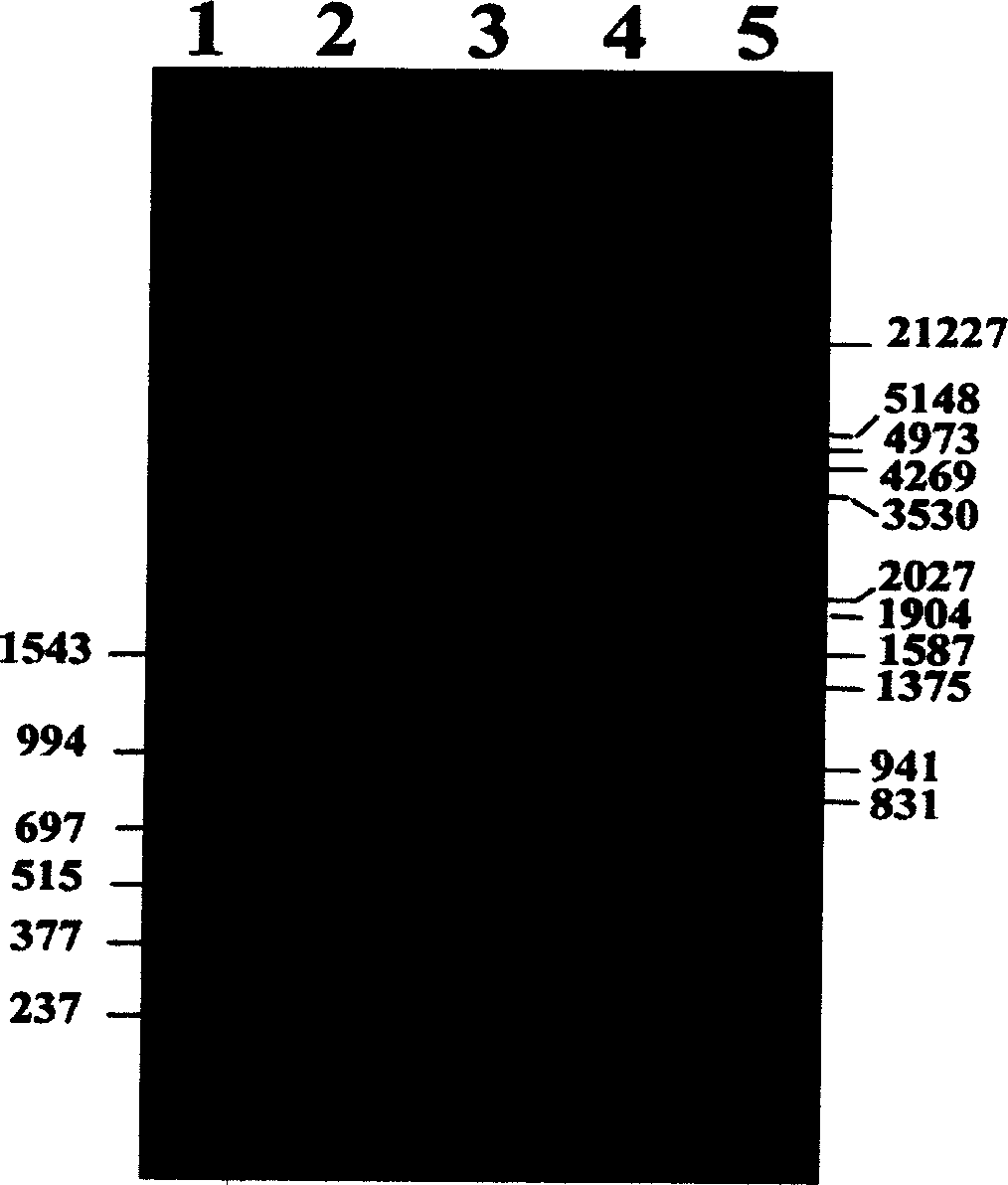 Gene of earthworm plasmin and genetic engineerng strain, construction and application