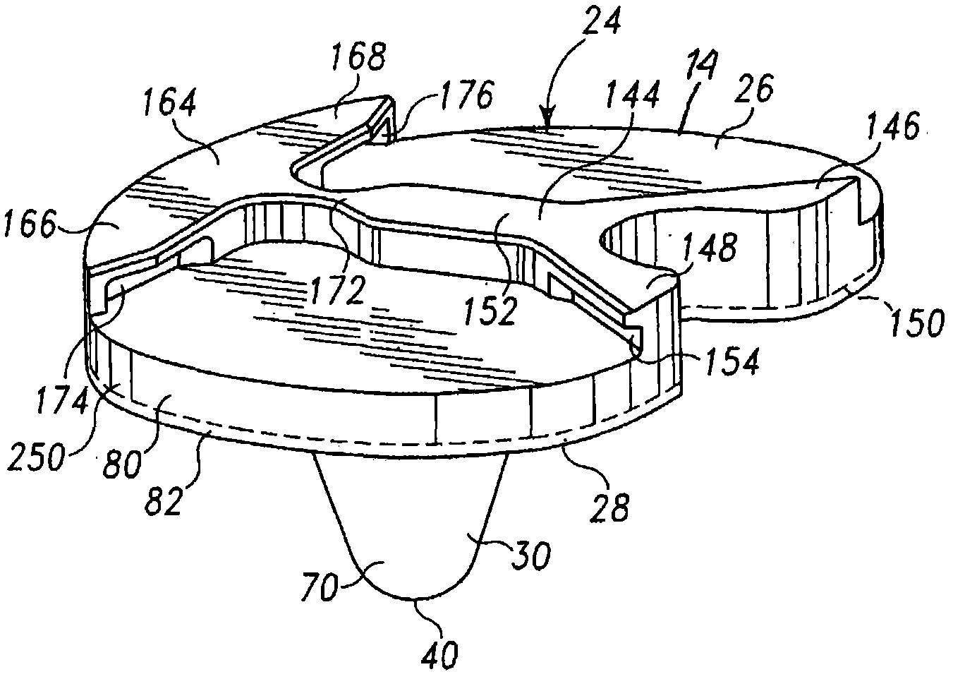 Prosthesis with composite component