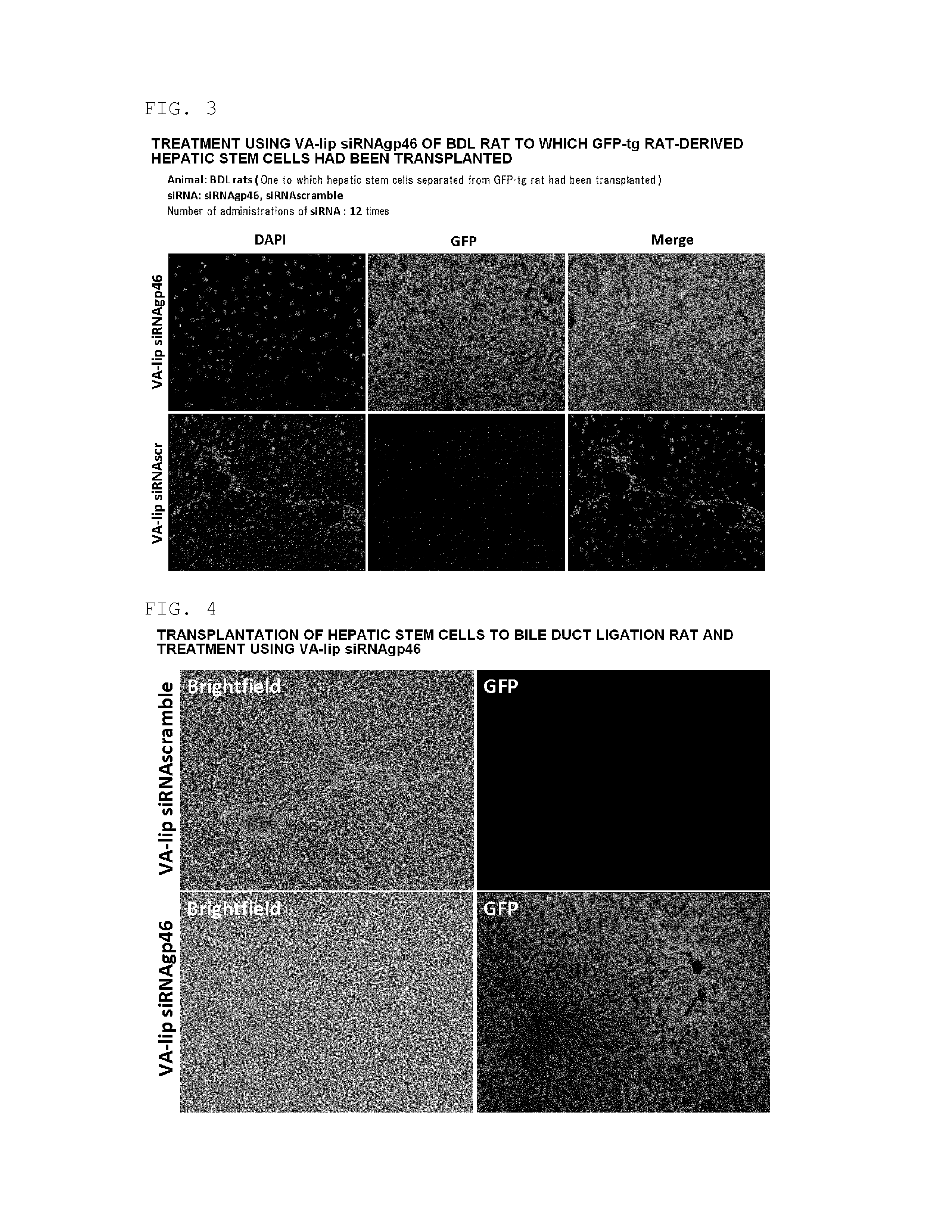 Composition for regenerating normal tissue from fibrotic tissue