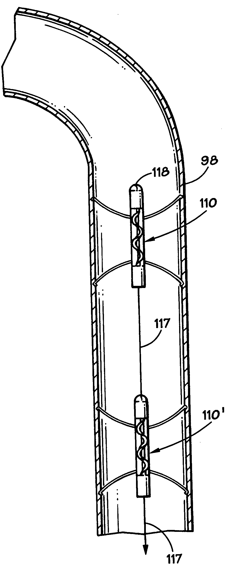 Method and apparatus for long-term assisting a left ventricle to pump blood