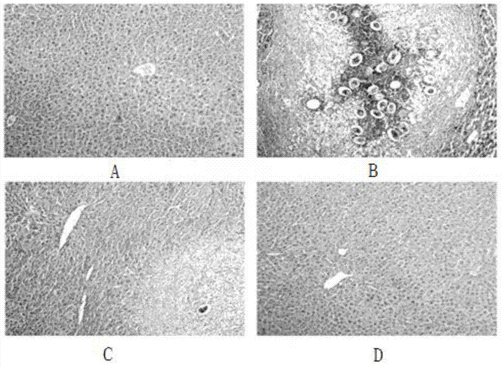 A kind of pharmaceutical composition for preventing and treating acute schistosomiasis infection