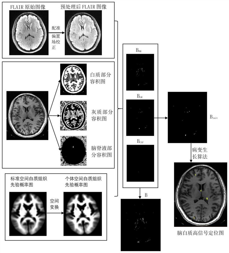 White matter high signal extraction method and system based on lesion diffusion algorithm