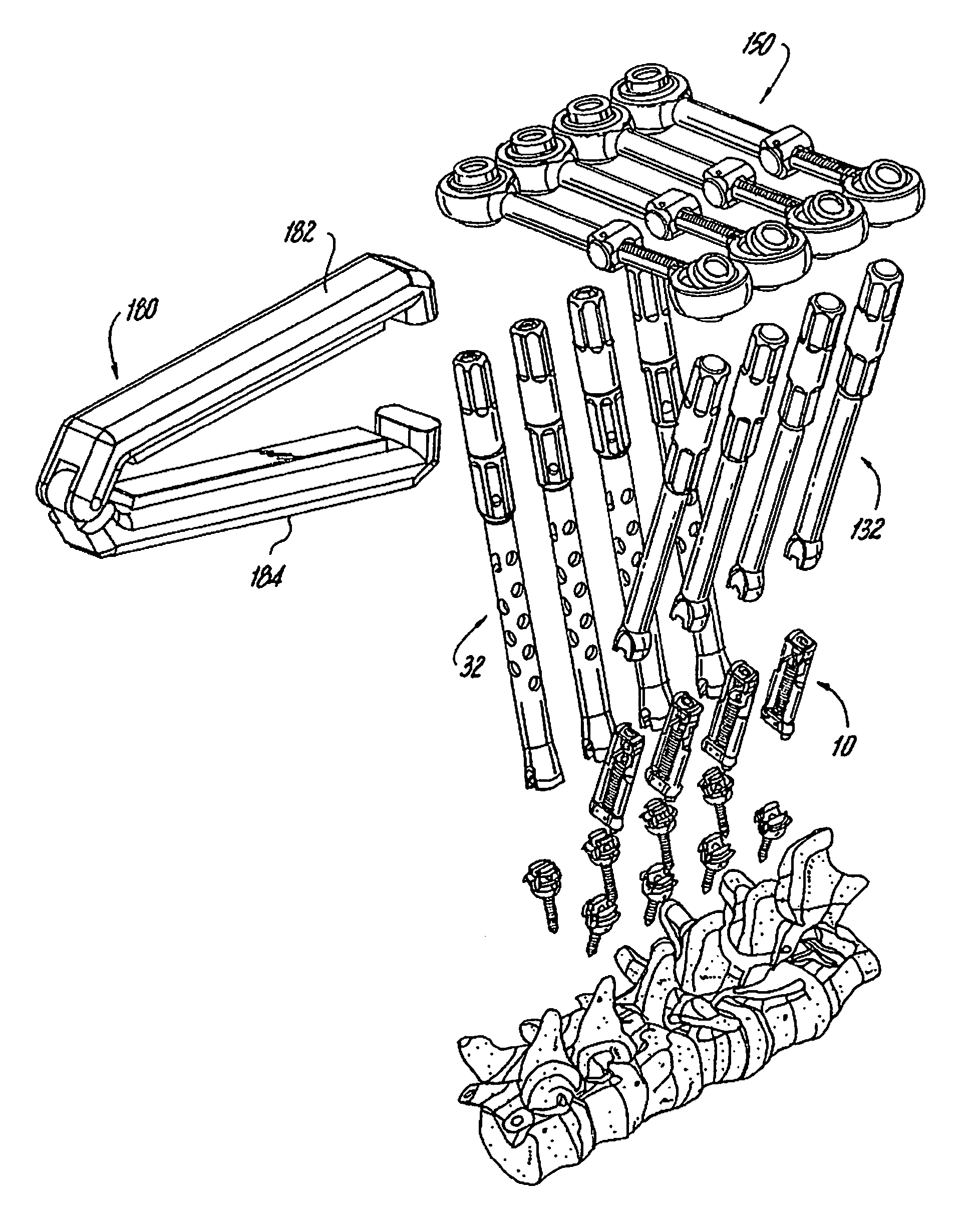 System and method for performing spinal surgery