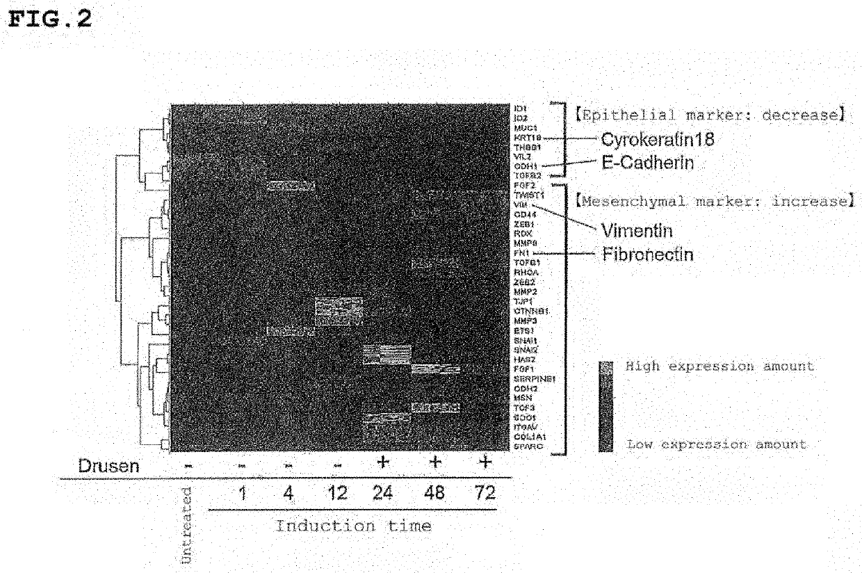 Choroidal neovascularization suppressor or drusen formation suppressor, and method for assessing or screening for same