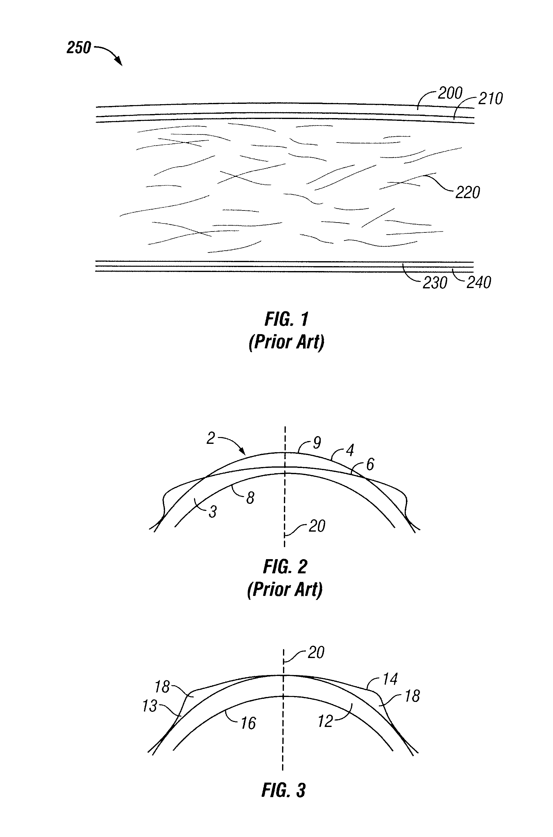 Orthokeratological contact lenses and design methods therefor