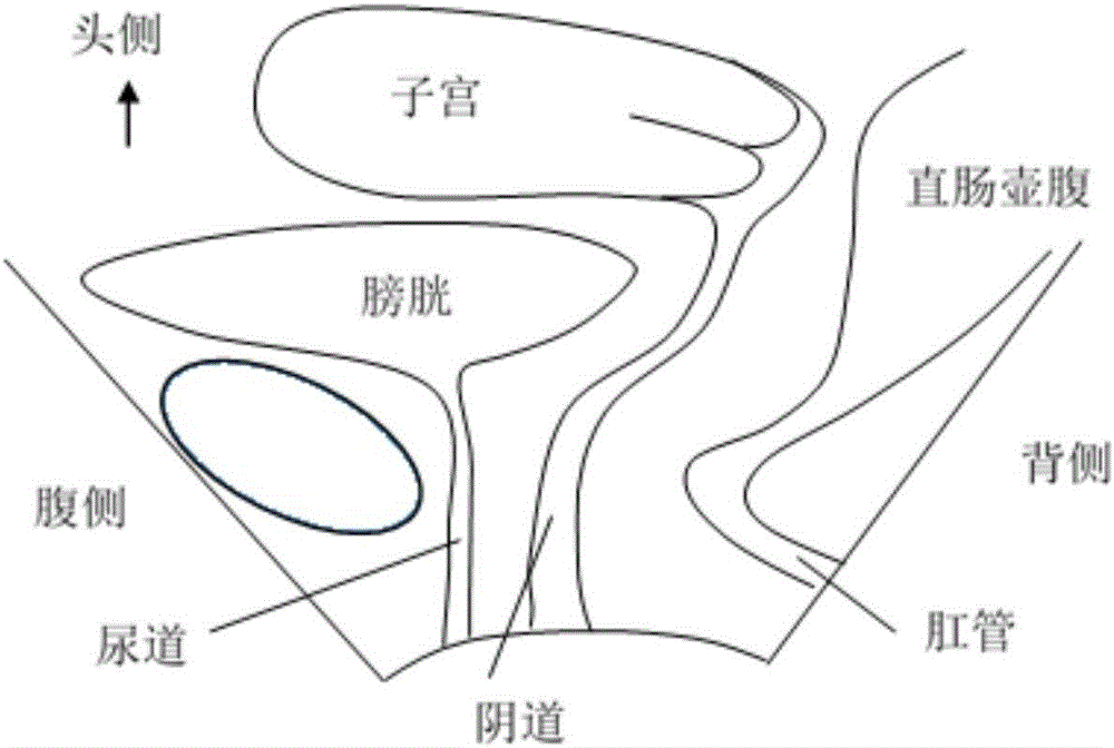 Anal levator shaft plane image processing method and device thereof