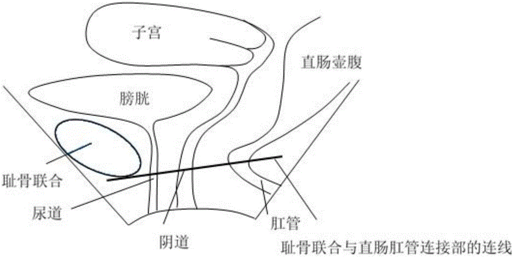 Anal levator shaft plane image processing method and device thereof