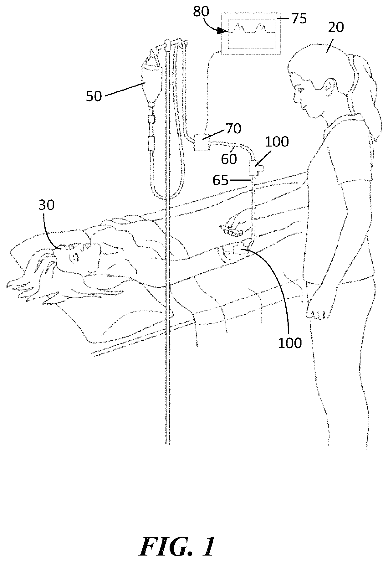 Sampling port for hemodynamic monitoring systems