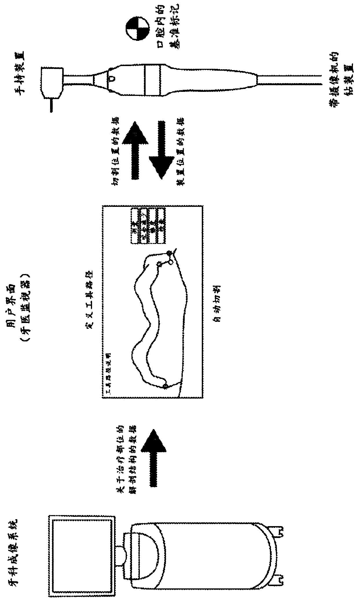 Automated dental treatment system