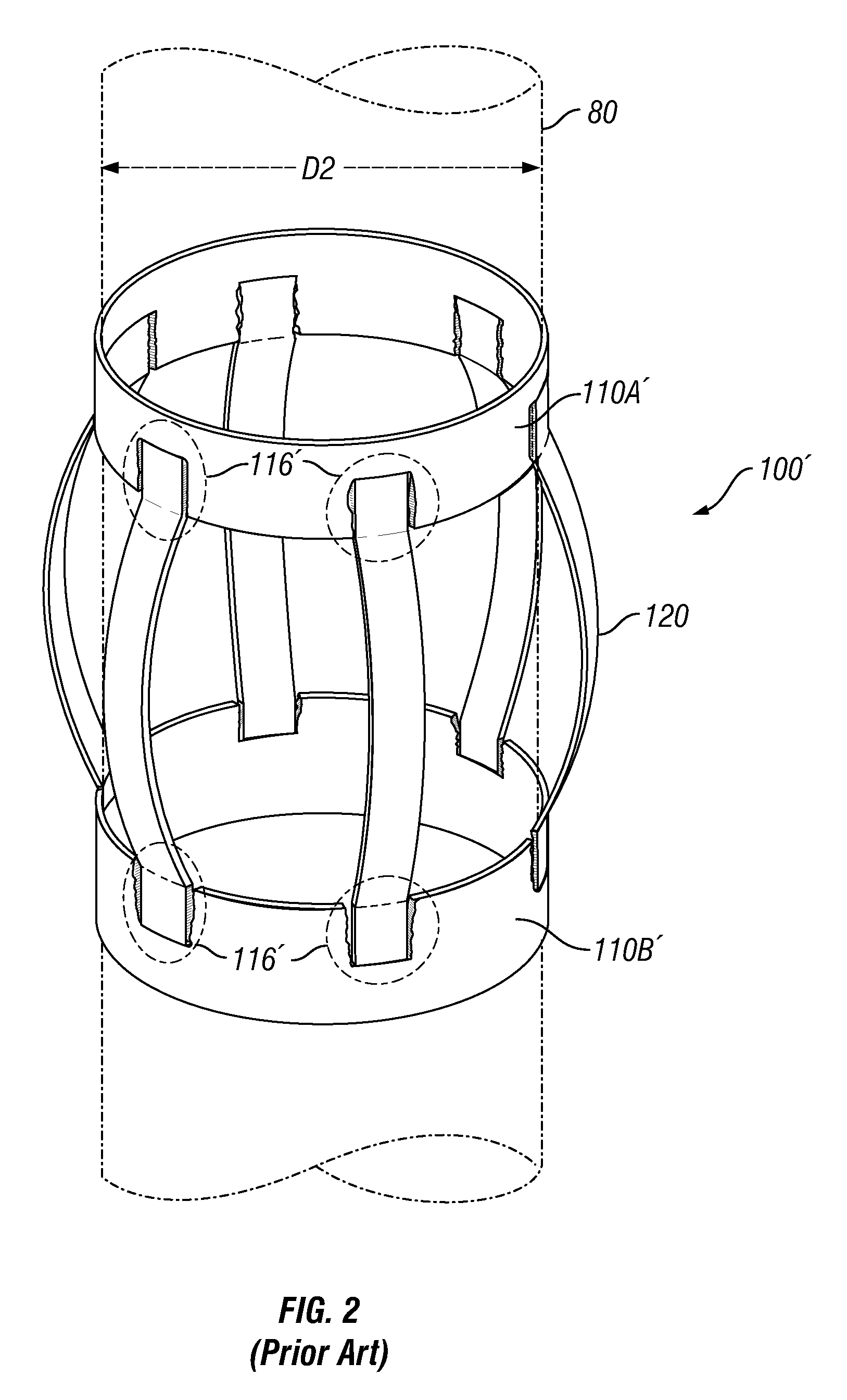 Expandable centralizer for expandable pipe string