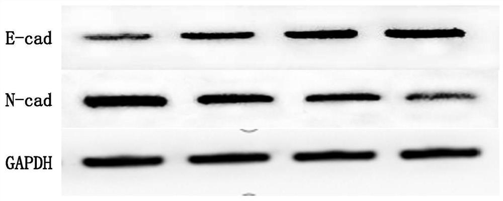 Application of pueraria flower spleen-strengthening-relieving formula drug-containing serum in cancer cells