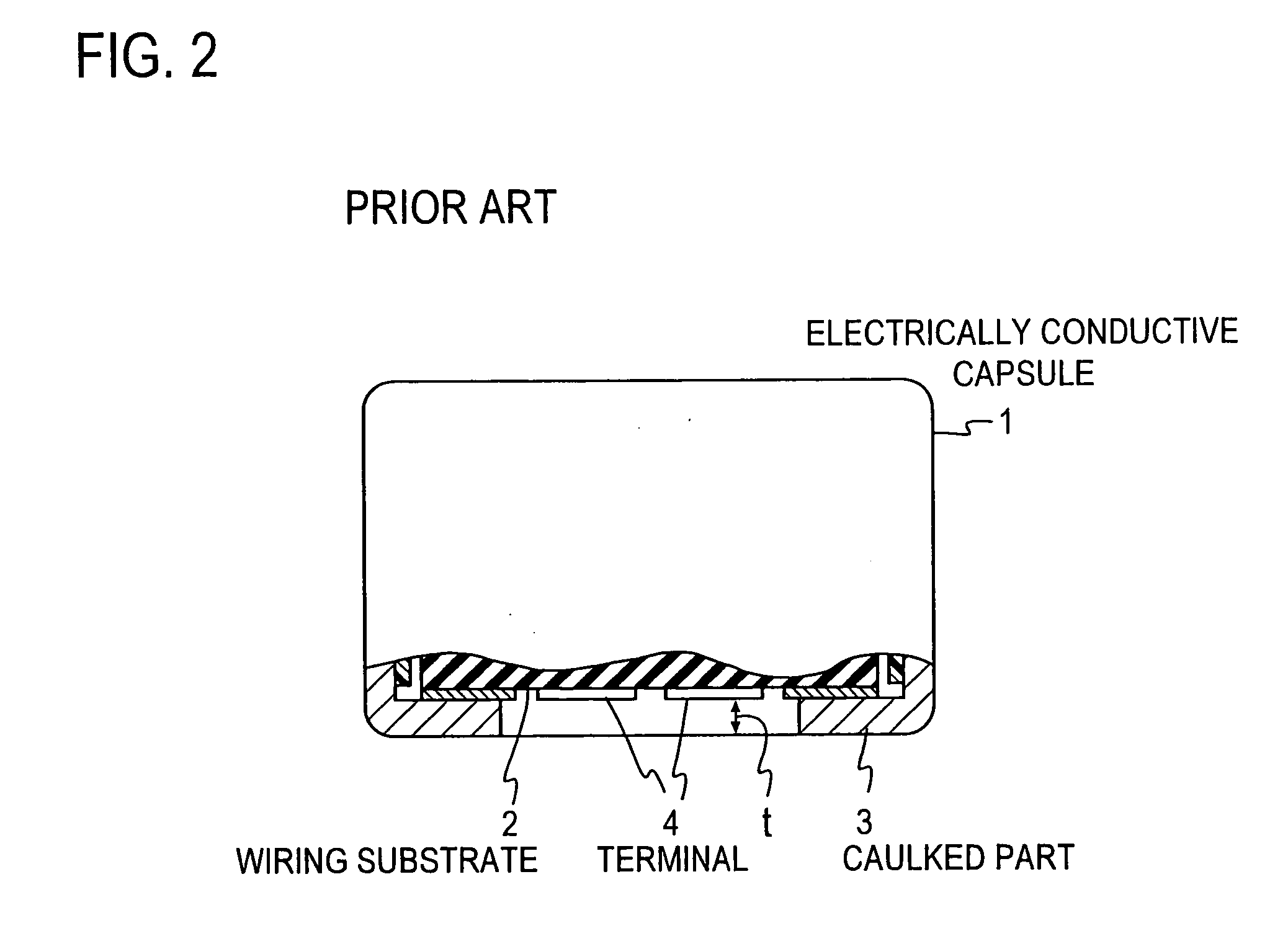 Electret condenser microphone