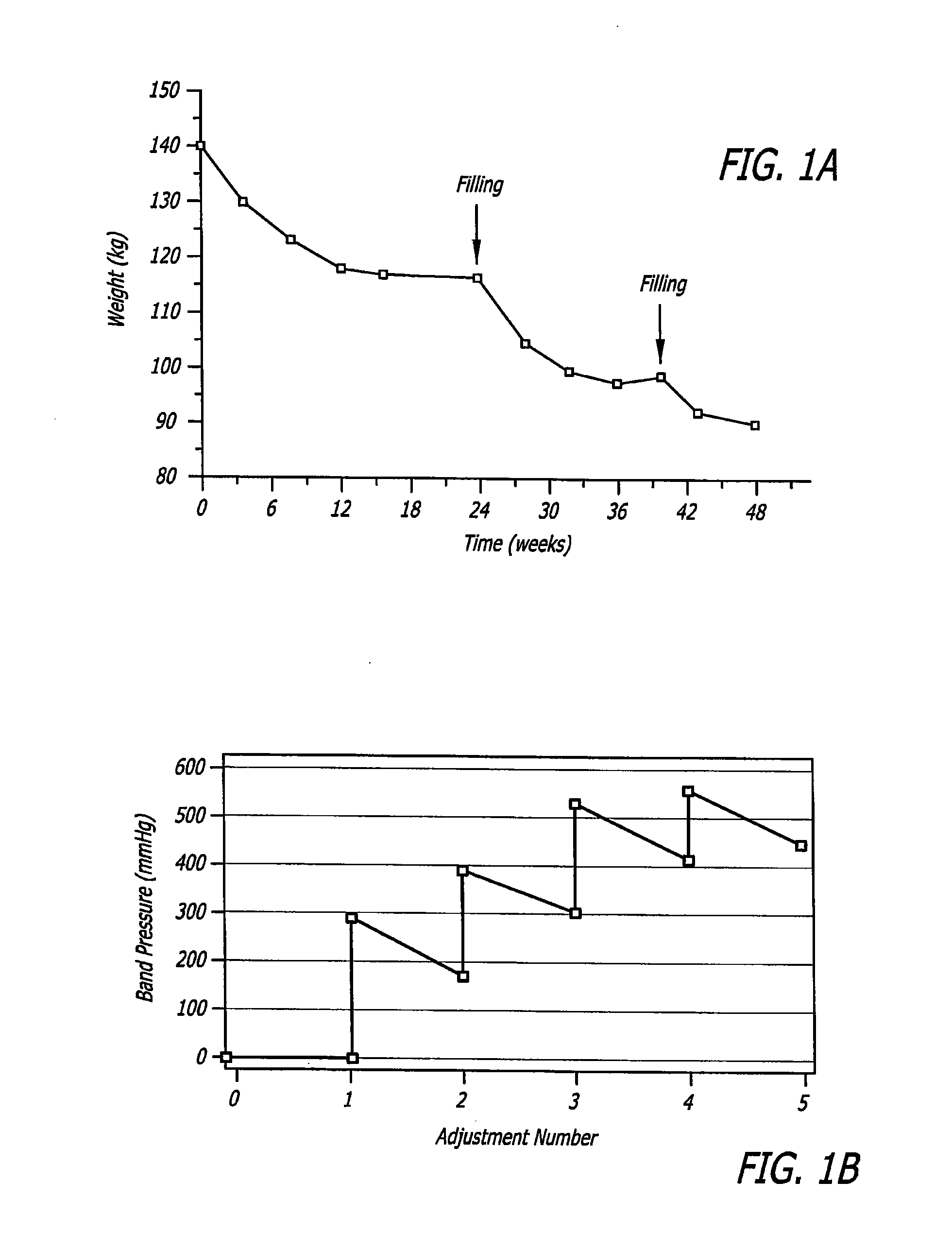 Assembly and method for automatically controlling pressure for a gastric band