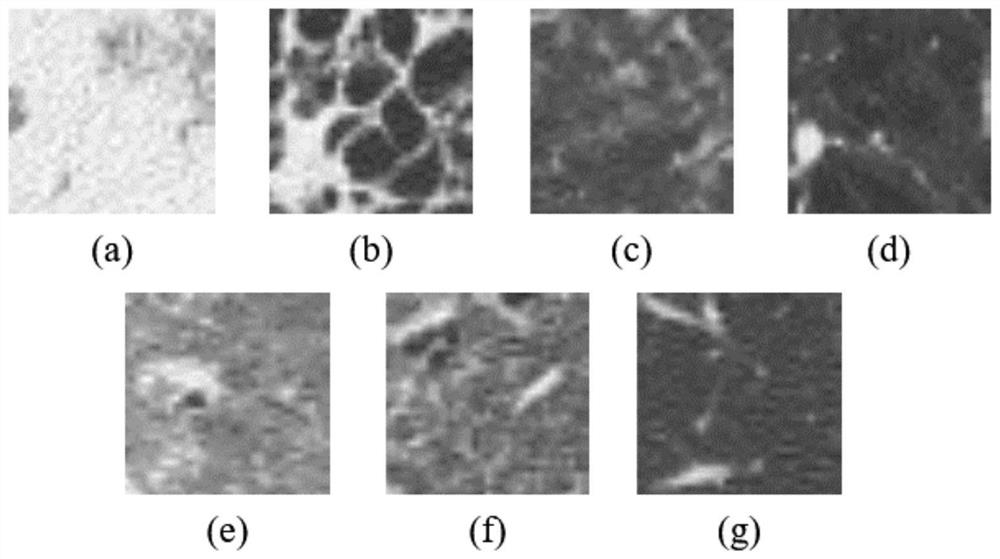 Deep network lung texture recognition method combined with multi-scale attention