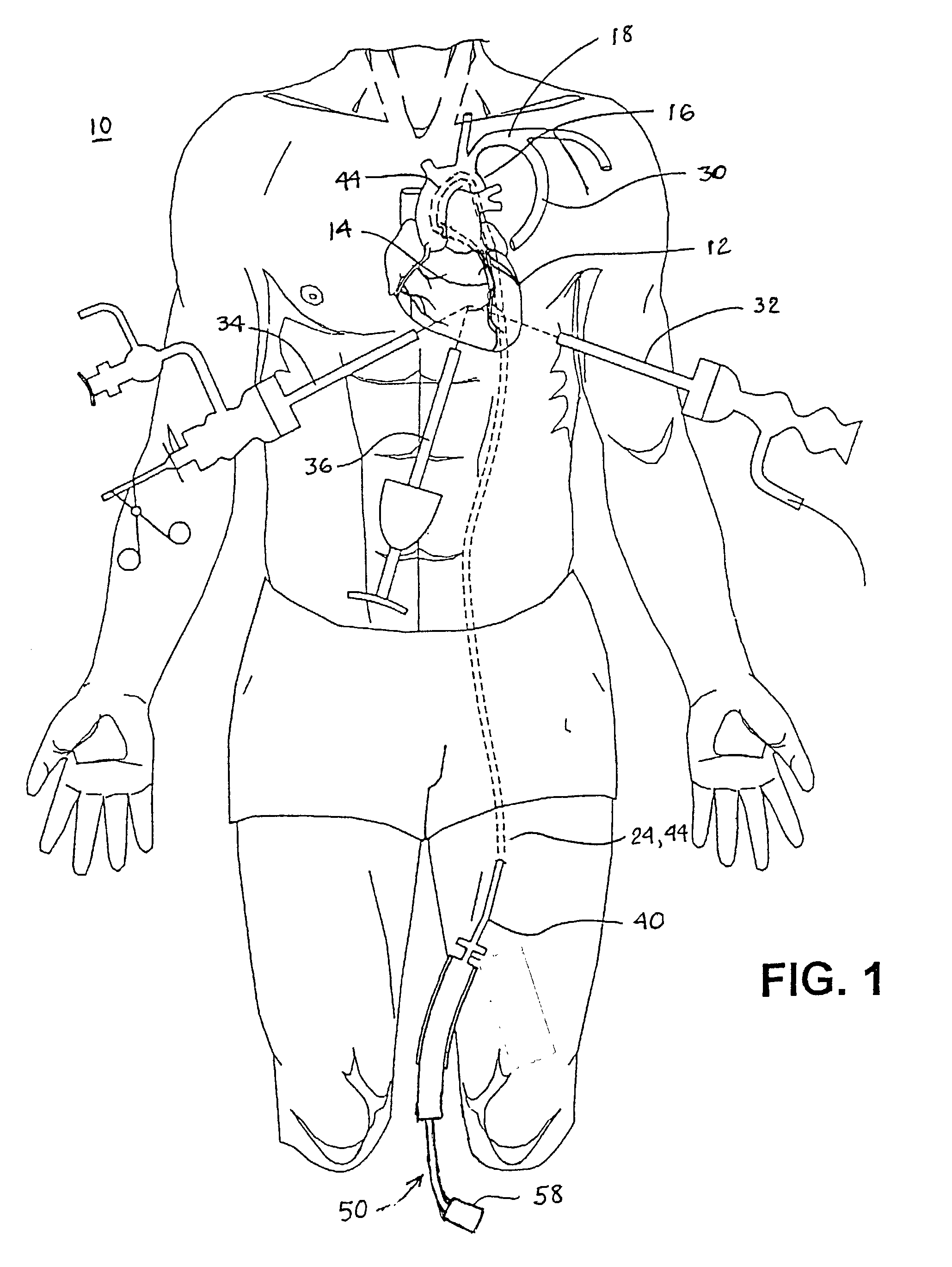 Methods and apparatus for locating body vessels and occlusions in body vessels