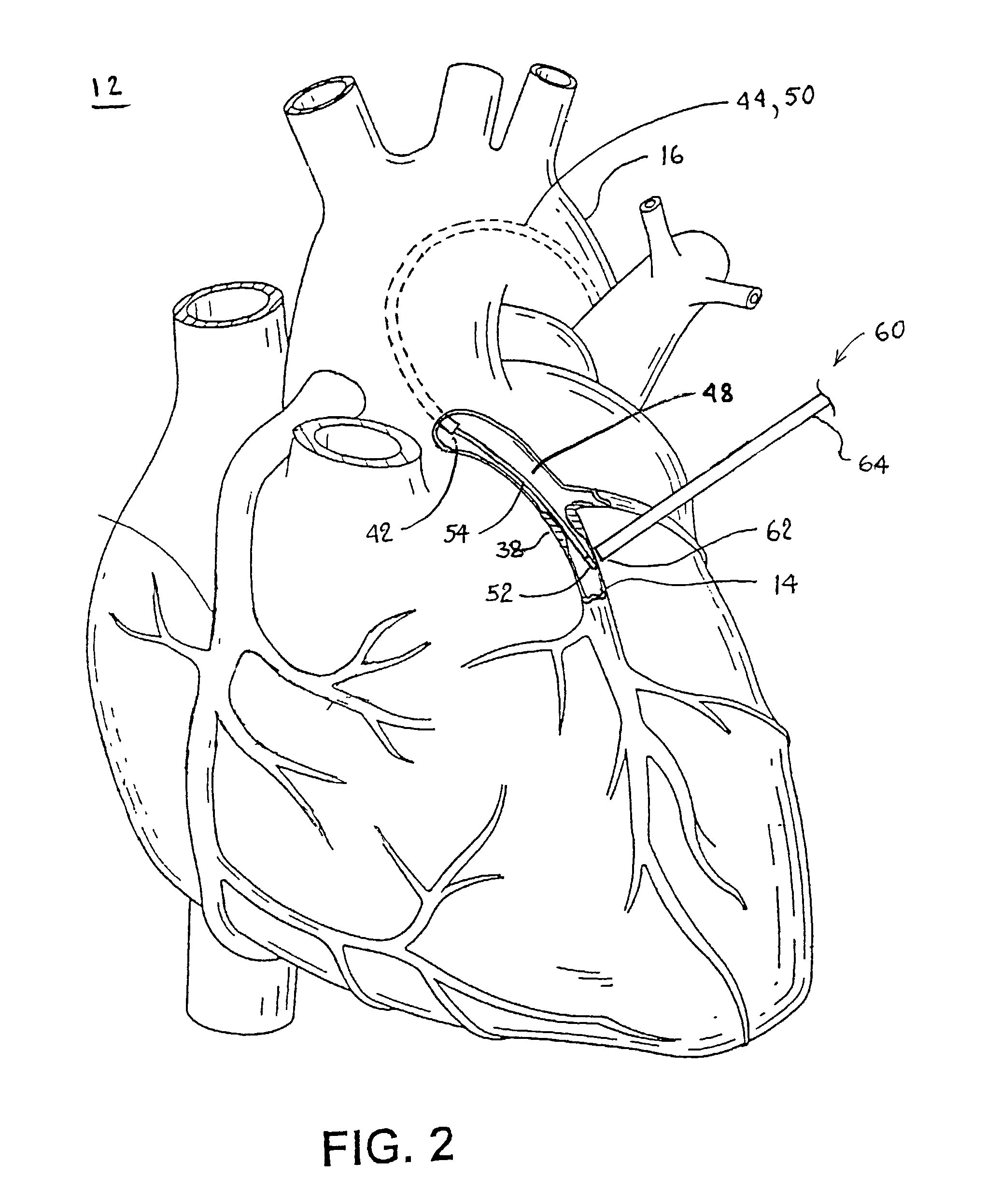 Methods and apparatus for locating body vessels and occlusions in body vessels