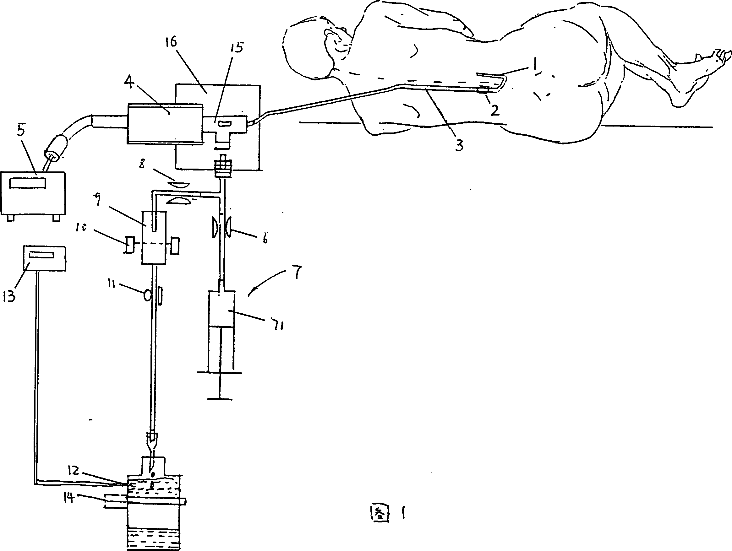 Monitoring and therapeutic apparatus for draining and displacing cerebrospinal fluid and pressurizing