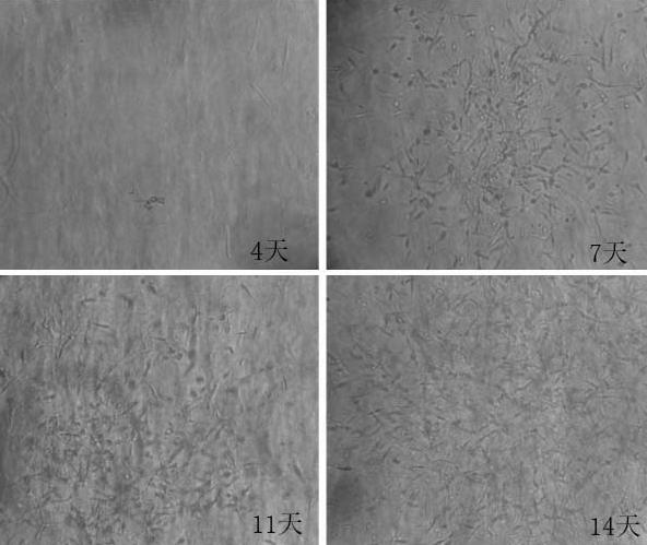 Gel matrix based on dopamine grafted zwitterionic polyphosphorylcholine modified type I collagen and preparation method of gel matrix