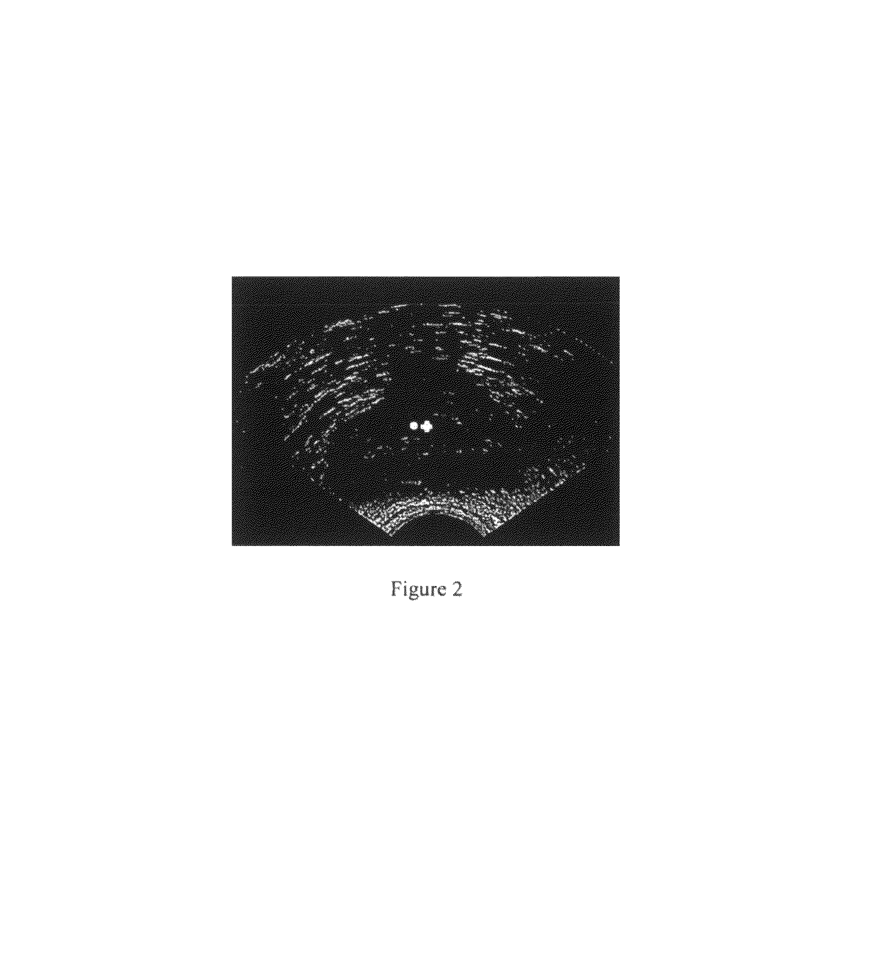 Method for automatic boundary segmentation of object in 2D and/or 3D image