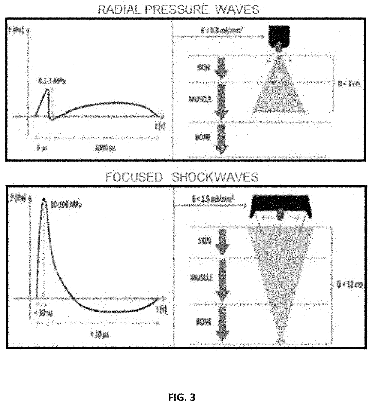 Shockwave and Pressure Waves for Treatment of Virus or Bacteria-Induced Effects in Human or Animal Lungs