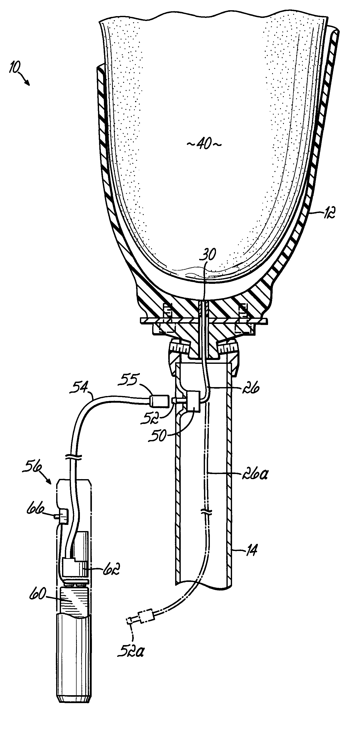 Prosthetic device utilizing electric vacuum pump