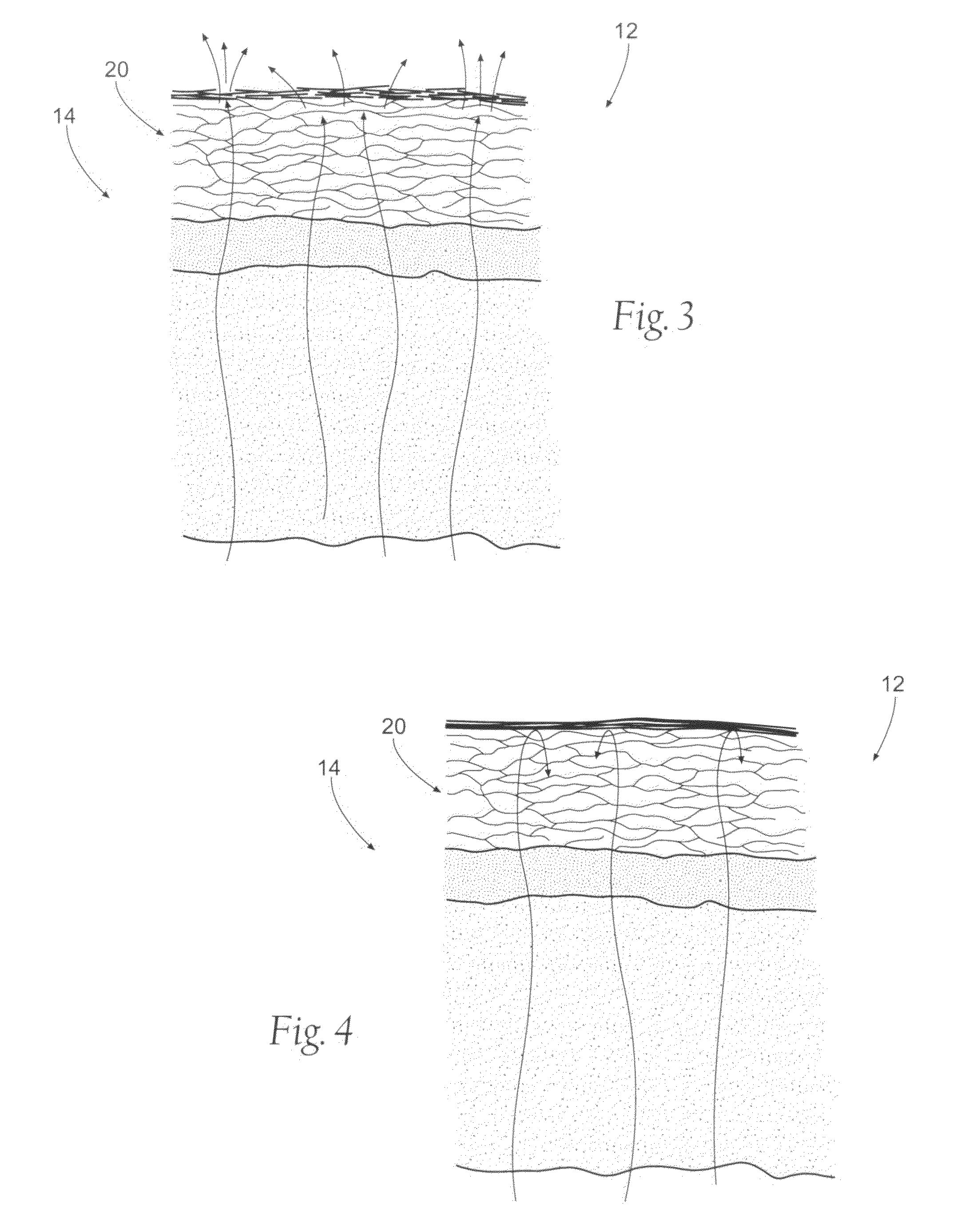 Assemblies, systems, and methods for skin treatment incorporating oxidized cellulose