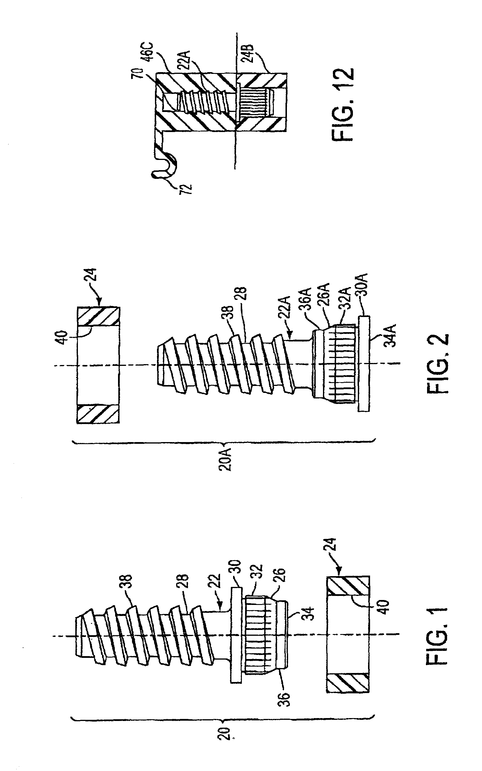 Quick assembly fastening system for plastic parts