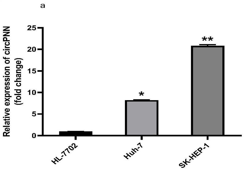 Molecular marker for detection or curative effect evaluation of liver cancer and application