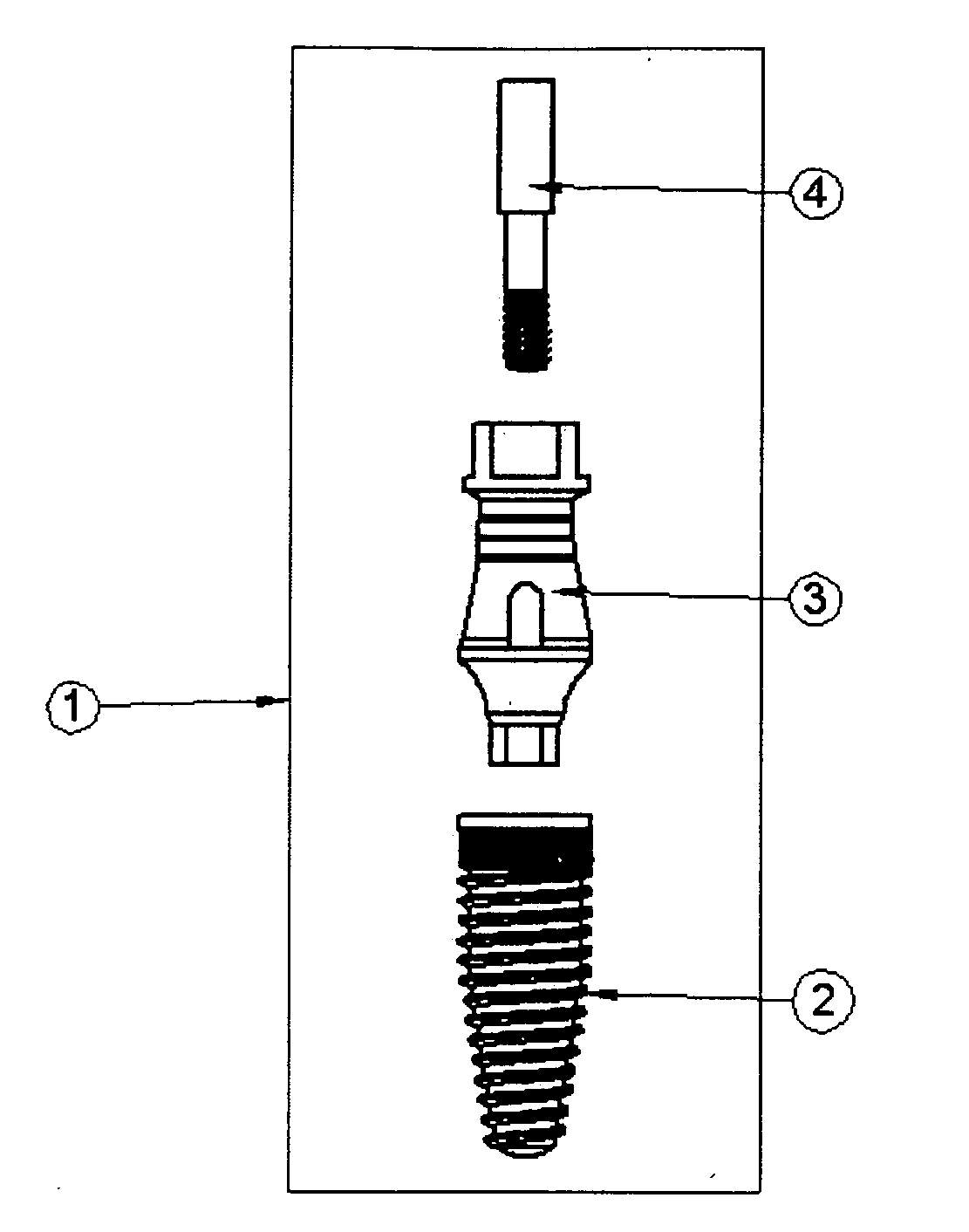 Dental implant system